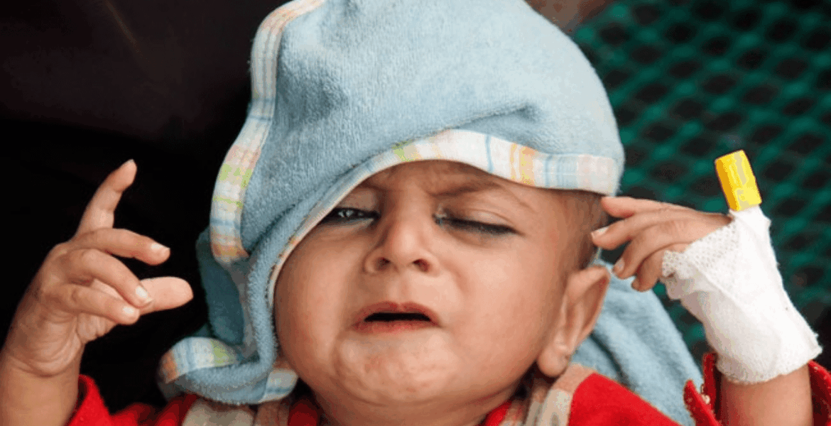 Dehidrasi Bayi 2025