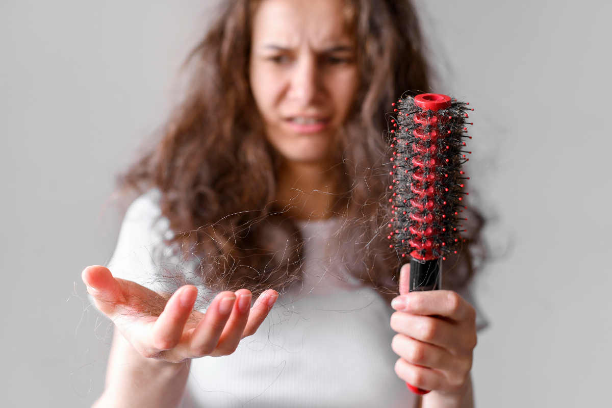14 Tips Atasi Rambut Rontok Berlebihan Ilustrasi rambut rontok berlebihan untuk artikel 14 Tips Mengatasi Rambut Rontok Berlebihan